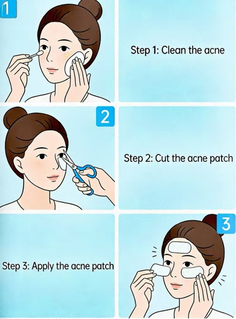 Paraan ng Paggamit ng Cmalbio Acne Patch at Pang-araw-araw na Pangangalaga para sa Acne