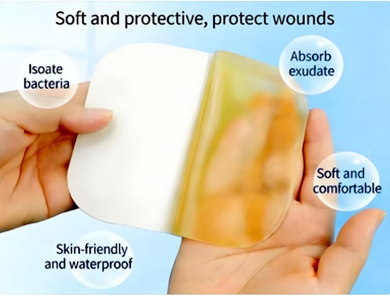 Hydrocolloid Dressings: Isang Makabagong Pagpipilian para sa Pangangalaga sa Sugat