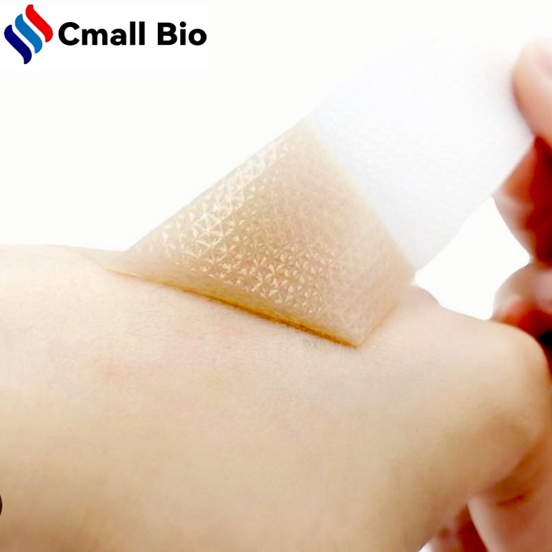 Ano ang Dapat Gawin Tungkol sa Pula at Makati na Peklat? Makakatulong ang CmallBio Silicone Gel Scar Sheet Ano ang Dapat Gawin Tungkol sa Pula at Makati na Peklat? Makakatulong ang CmallBio Silicone Gel Scar Sheet