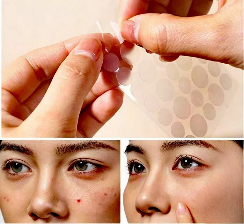 Paano Gamitin ang CmallBio Pimple Patches Magdamag para sa Pinakamataas na Resulta?